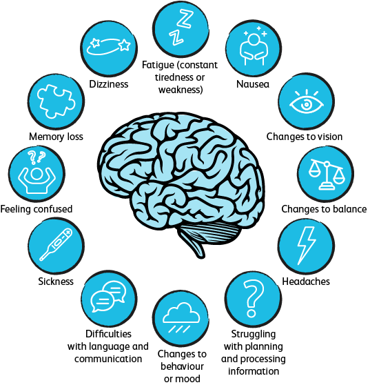 Signs of concussion