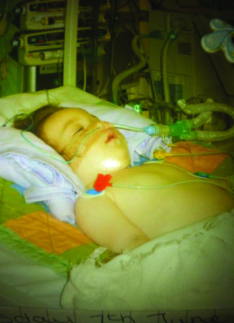 Millie on life support at the hospital